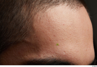 HD Face Skin Shawn Jacobs face forehead hair skin pores…